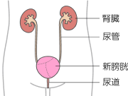自排尿型新膀胱造設術による人工膀胱（新膀胱）と尿路のイラスト