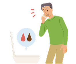 尿の色が赤や茶色になっていて驚く男性のイラスト。膀胱がんの初期症状である血尿に気づいたシーン